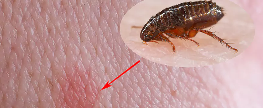 Flea Control for Humans Lake Forest, CA